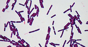 阿姆斯為您揭曉<i style='color:red'>生物菌肥</i>是不是含菌量越高越好呢